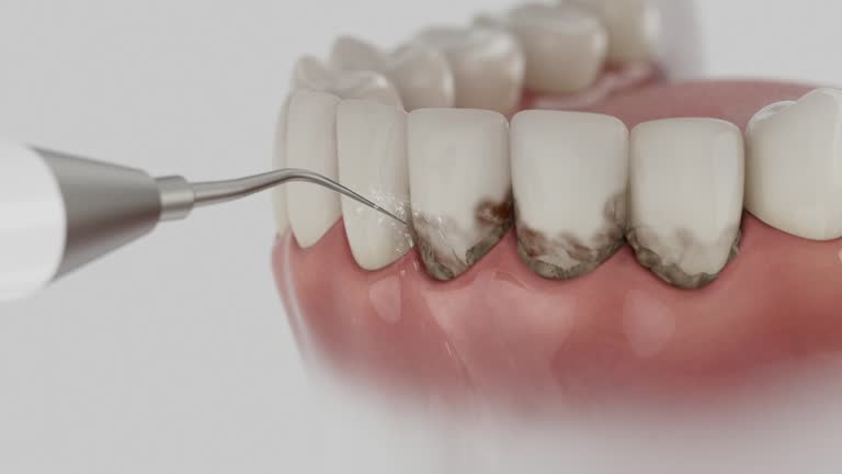 Reliable Dental Implants contractor in Elyria, OH by Smile Center Dentistry